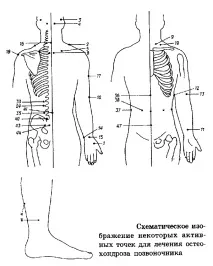 Точковий масаж при болях у спині болях
