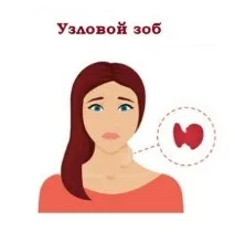 Вузловий зоб причини появи та схема лікування захворювання у 2019 році появи