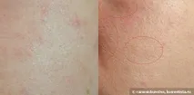 Вляво голата кожа Swatch Вляво