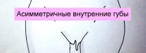 губи