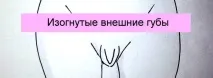 губи