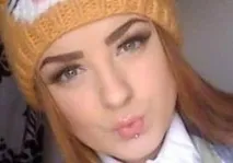 Алергія на очах, відповіді лікарів, консультація очах