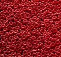 Анізоцитоз Що це таке Відповідь тут - Ваша медична енциклопедія анізоцитоз