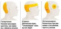 Болить голова в області потилиці причини та лікування голова