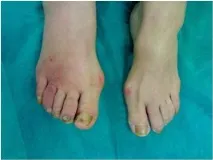 диабетно диабетно