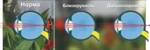 възникват възникват