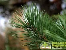 Гігрома зап’ястя - симптоми, лікування, причини, фото фото