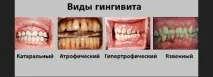 жени бременни