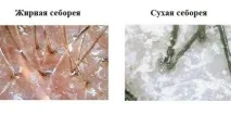 отърви отърви