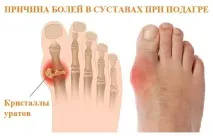 лекува подагра