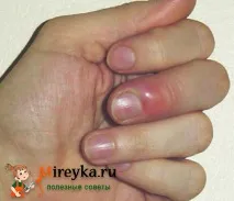 лекува дома