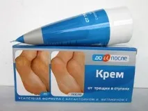 Крем для ніг від тріщин - вибір хорошого загоює крему загоює