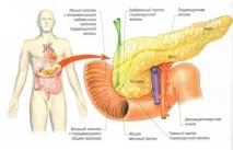 Лікування раку підшлункової залози в Ізраїлі. підшлункової