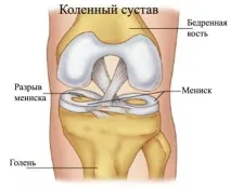 гриж