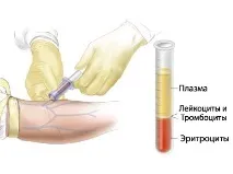 Лімфома Ходжкіна у дітей - Огляд - Біла Клініка ходжкіна