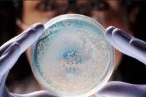 mycoplasma hominis