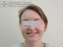 адентия ортодонтско