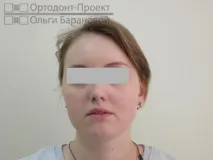 лечение лечение