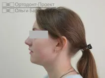 ортодонтско ортодонтско