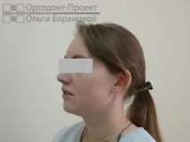 ортодонтско ортодонтско