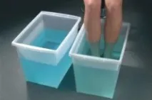 плоскостопість