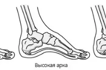 възраст лечение