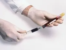 пероксизомни заболявания