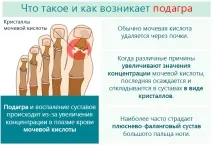 краката краката