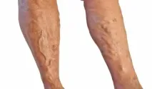 причините причините