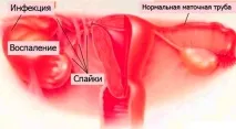 лікування