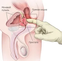 чоловіків