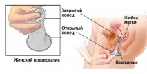 контрацепция контрацепция
