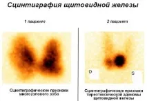 подготовка показания