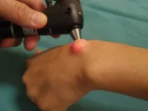 отстраняване отстраняване