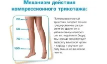 підколінної