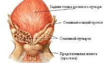 Запалення насіннєвих бульбашок запалення
