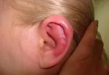 Запалення вуха ускладнення, їх симптоми та лікування запалення