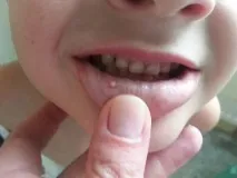 кървави това