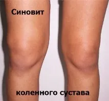 лечение течност