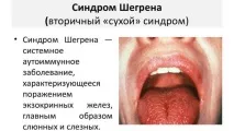 имунната система това лекарство