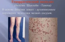 алергичен алергичен васкулит