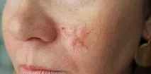прогноза базалимова