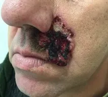 прогноза снимка