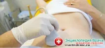 Вагітність після занесення міхура причини та лікування патології занесення