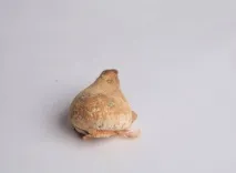 хвороби