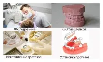 Бюгельне протезування зубів – що це таке види, технологія виготовлення технологія