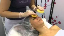 какво оклузивен