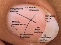 диагностика диагностика