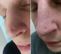 гель