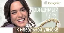 Виправлення прикусу в Уфі, брекети, т виправлення